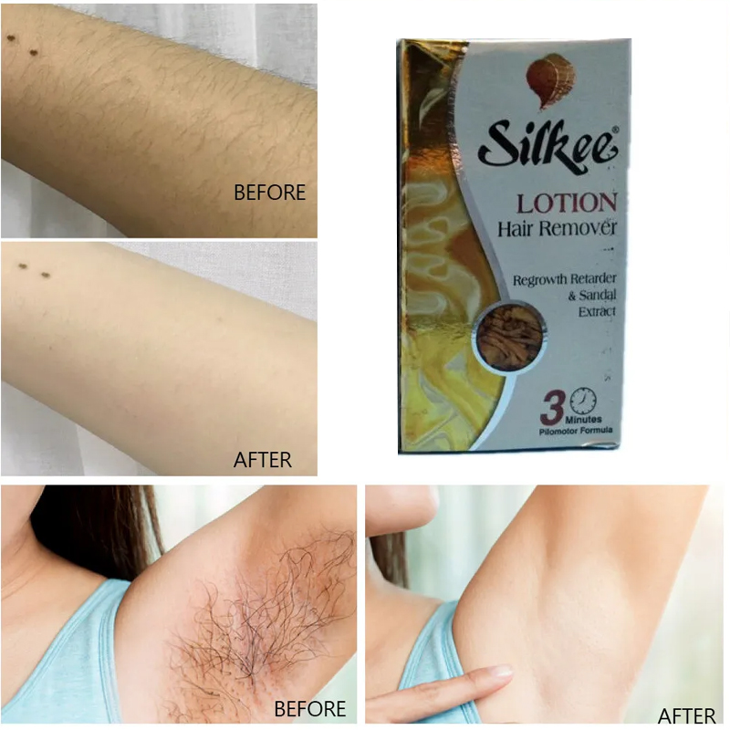 シルキーCM脱毛ローション 1本 ナチュラル 無痛 鎮静 腕 - Body Lotion のレビューと価格